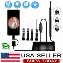 Earwax through the USB data cable. Type A-Ear Endoscope. -Ultra small lens with HD pixels, easy access ear canal and...