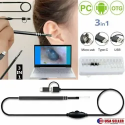 Earwax through the USB data cable. -Ultra small lens with HD pixels, easy access ear canal and see more clearly. It not...