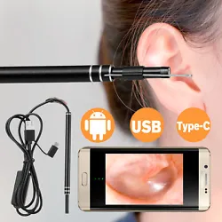 1 x Ear Endoscope. It not only can check the ear canal, but also can check the eardrum, mouth, gums, throat, nasal...
