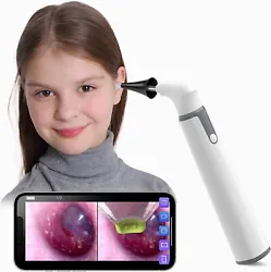 Compatible with iPhone & Android - Our WiFi otoscope works well Apple iOS, Android phone or tablet. The otoscope should...