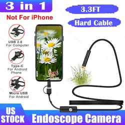 1M 6LED 7MM Endoscope. (2) You need an OTG cable. ◎【Support System】 ①Support phone: Only Android. Model7mm USB...