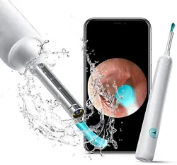 Super Light Lens and Constant Temperature: The otoscope can reach the eardrum and deep of the ear canal. A protection...