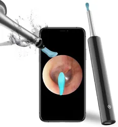 Make removing earwax clearer, safer and more accurate. 【Stylish Design & Friendly User Interface】 - The ear scope...