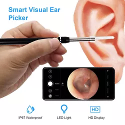 Make removing earwax clearer, safer and more accurate. The ear scope is light to carry and simple enough to use, soft...