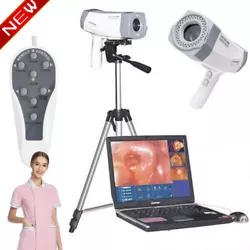 RCS-400 digital electronic colposcope is applicable to detect vulva, vagina, cervical disease diagnosis and inspection,...