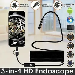 1 Endoscope. Model7mm USB Endoscope 6 LED Waterproof. You can use this endoscpoe with Android smartphone/ Windows PC/...