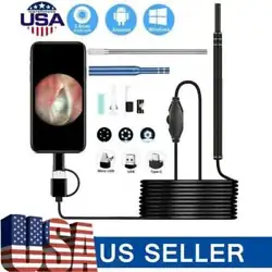 Earwax through the USB data cable. -Ultra small lens with HD pixels, easy access ear canal and see more clearly. It not...