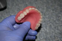 Dentures Now.How to Make Your own Dentures/Temporal Denture. DENTURE NOW is a new product designed exclusively for...
