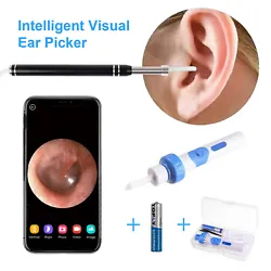 Make removing earwax clearer, safer and more accurate. Ear Endoscope Otoscope( first item). The new practical 