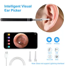 Make removing earwax clearer, safer and more accurate. 1x Ear Spoon. The ear scope is light to carry and simple enough...